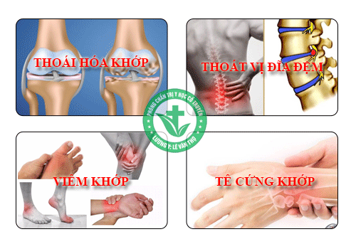 Thầy Lang Chữa Xương Khớp Ở Thanh Hóa